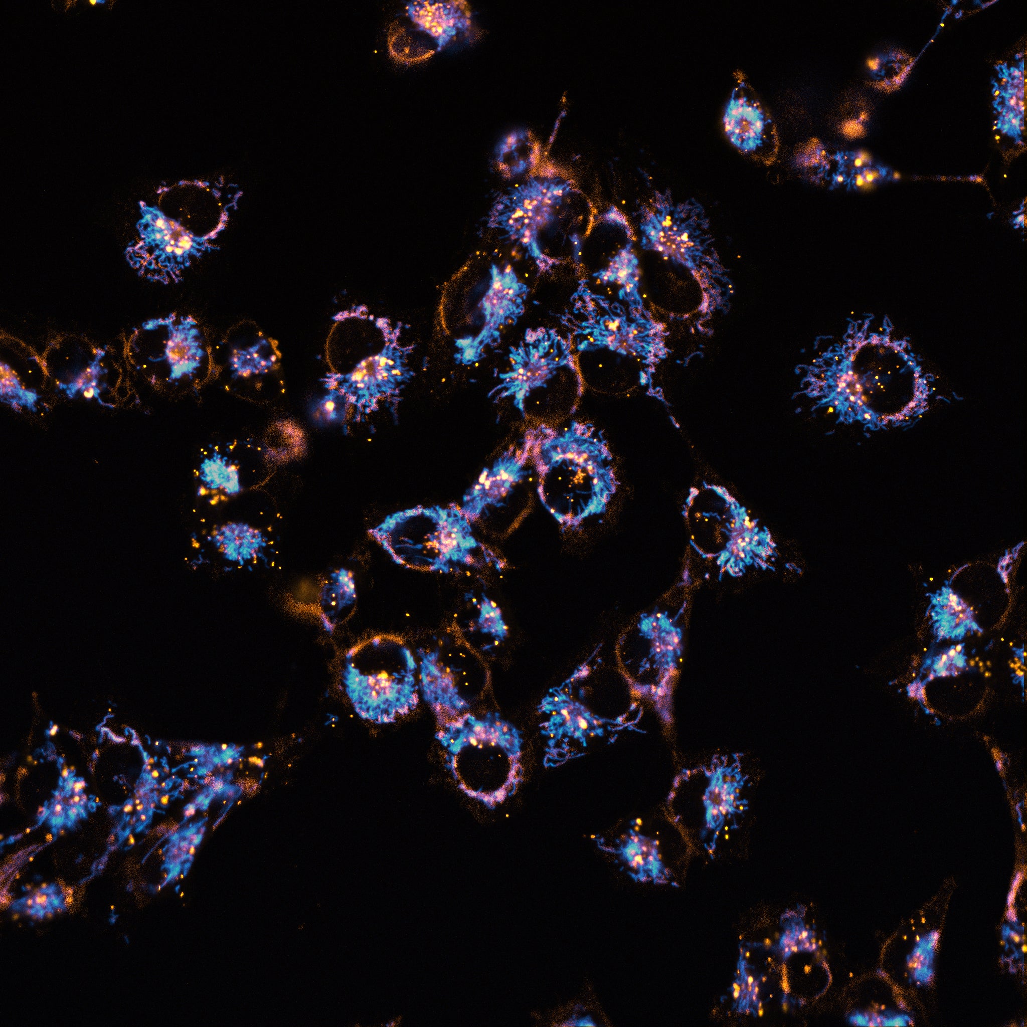 ChromaLive_stained_MCF-7_cells.jpg