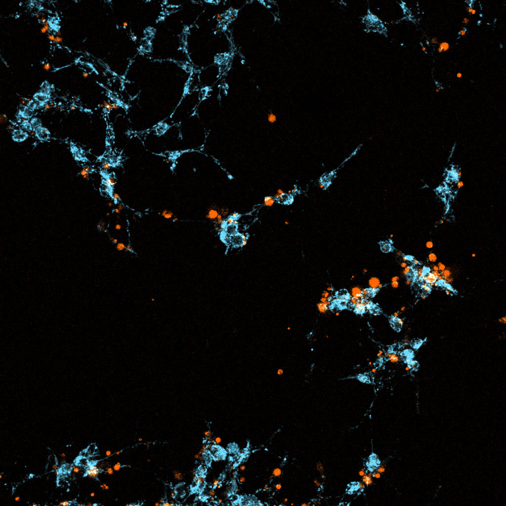 LIVE-Dead viability dye on cancer cells, real time cytotoxicity assessment
