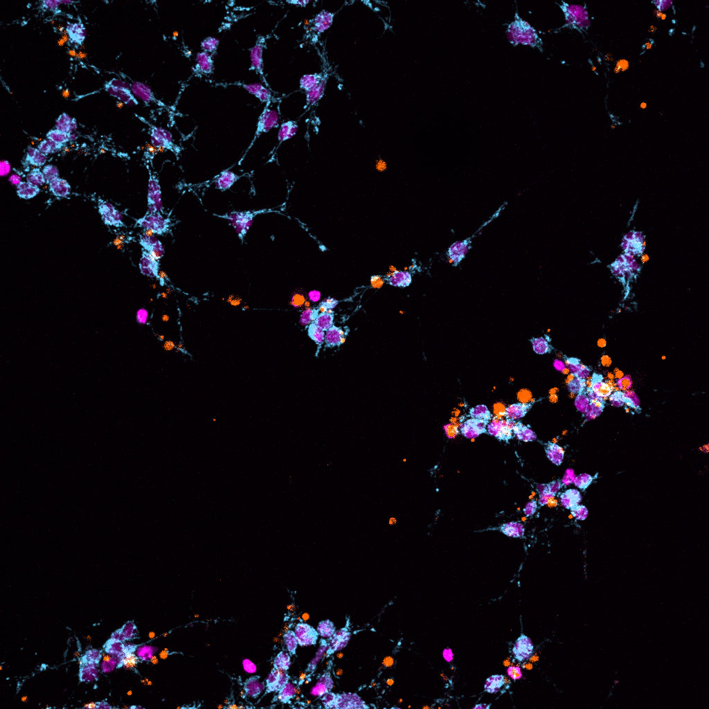 Real time monitoring of Cell viability and cytotoxicity using non-toxic, Live cell, Cell viability dye