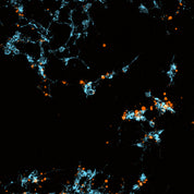 LIVE-Dead viability dye on cancer cells, real time cytotoxicity assessment
