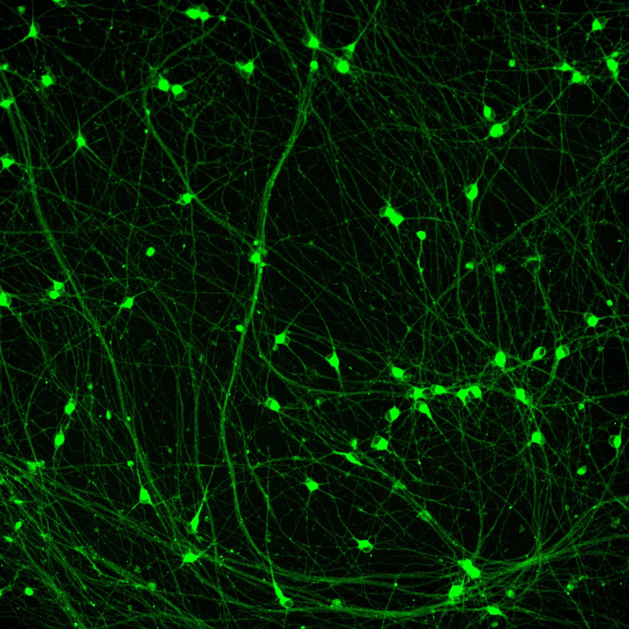 Neurons_LipoLIVE_1X_O08_F01_72h.jpg