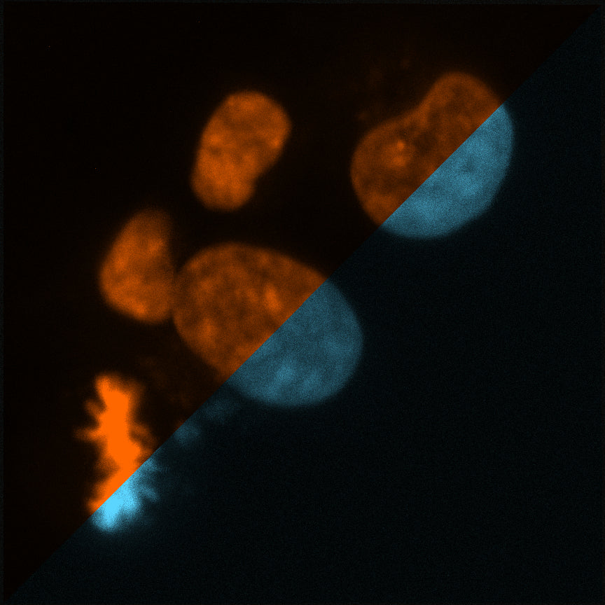 NucleoLIVE_co-stain_with_Hoechst_4h_40x_MCF-7_cells.jpg
