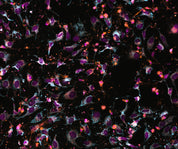 ChromaLIVE,  non-toxic, Livecell painting data rich dye for phenotypic profiling