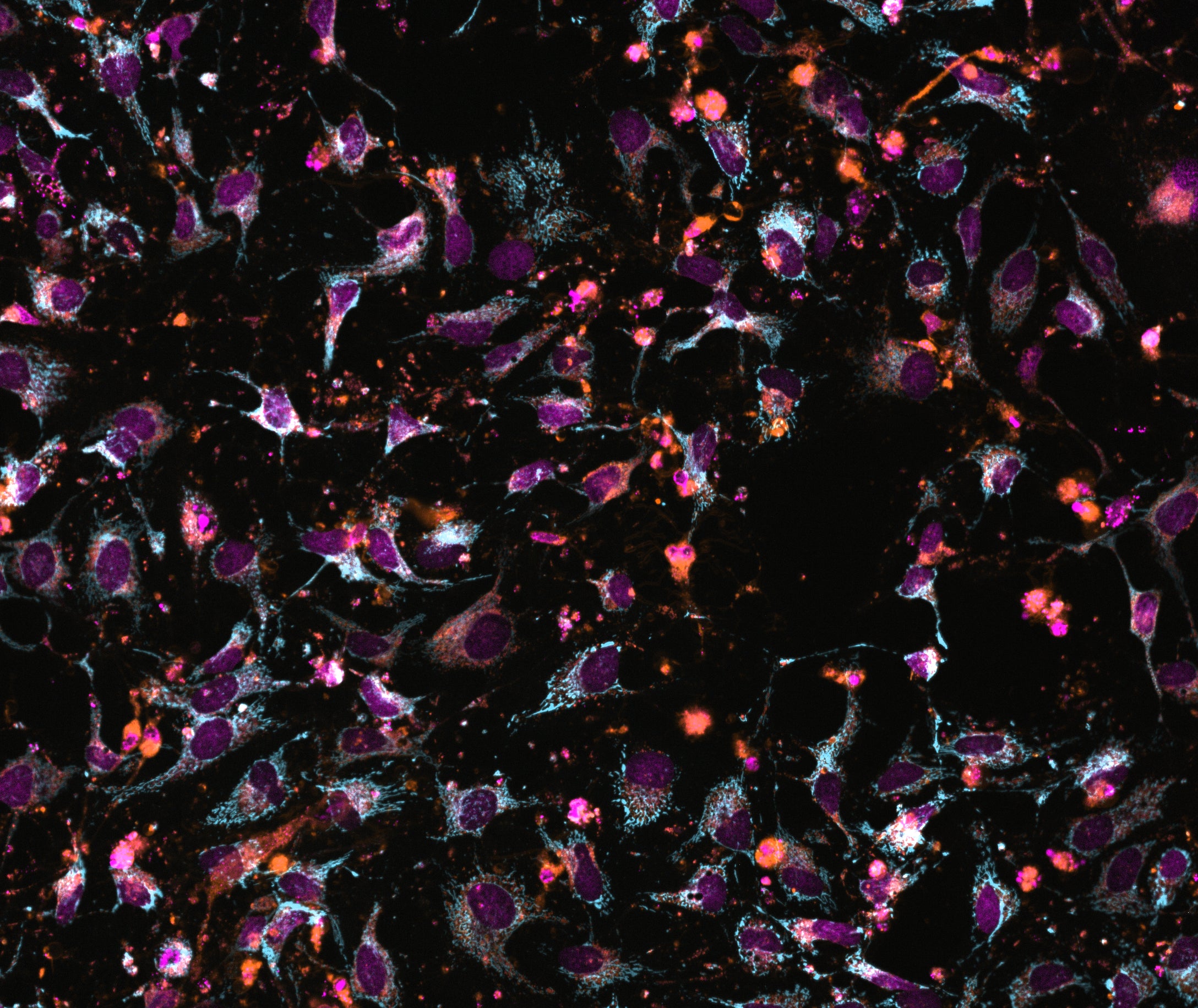 ChromaLIVE,  non-toxic, Livecell painting data rich dye for phenotypic profiling